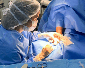 paciente com nódulo subungueal característico de tumor glômico