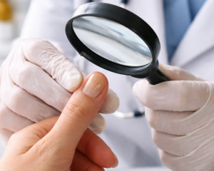 Dermatologista examinando unha alterada durante consulta especializada