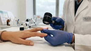 Dermatologista examinando unhas de paciente com dermatoscópio.