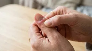 Mão feminina adulta pressionando a unha do polegar que apresenta inchaço e vermelhidão leve, indicando desconforto e necessidade de cuidado.